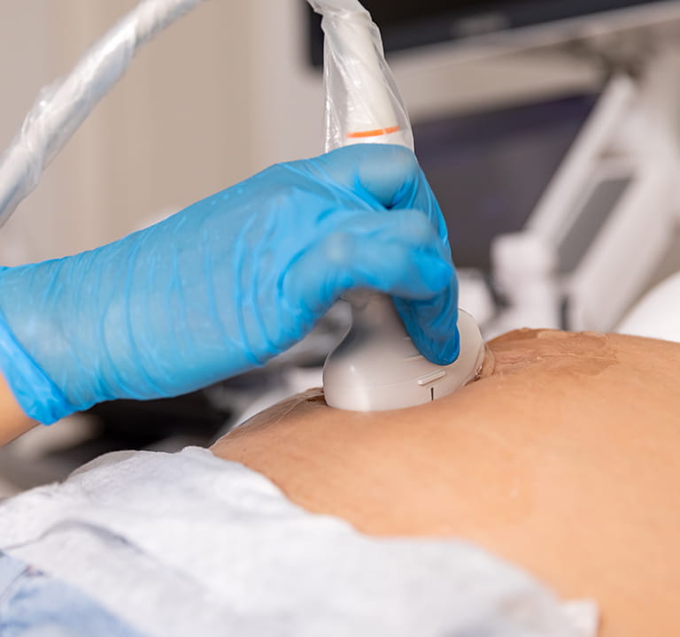 腹部エコー検査